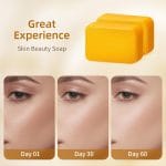 Kojic Acid Turmeric Soap Bar Dark Spots for Face & Body, Deep Cleansing, Gentle Soap Sensitive Skin Formula, All Skin Types 2Pack with Dish - Image 4