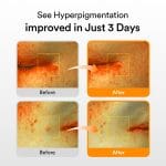 Abib Glutathiosome Dark Spot Serum Vita drop 1.69 fl.oz. | Korean Skincare, Dark Spot, Hyperpigmentation Treatment | Serum for Sensitive, Uneven Skin - Image 3