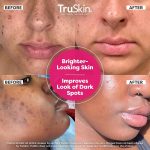 TruSkin Vitamin C Super Serum - Niacinamide, Retinol, Hyaluronic Acid & Squalane - All-in-One Anti Aging Serum for Face – Improve Appearance of Dark Spots, Firmness for Brighter Looking Skin, 1 Fl Oz - Image 3