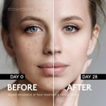 EnaSkin Dark Spot Remover for Face and Body: Advanced Formula Spot Corrector Cream to Fade Age Spots, Sun Spots, Freckles, Melasma, and Brown Spots for Women and Men (1.7 Oz) - Image 4