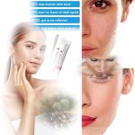 Generic Crema para Manchas Oscuras en La Cara, Dark Spot Remover for Face, Freckles Melasma Brown Spot Corrector for Men Women, Crema para Las Manchas de La Cara 20G - Image 3