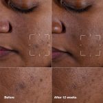 Clinique Even Better Clinical Dark Spot Clearing Vitamin C Face Serum For All Skin Types | Brightening + Soothing - Image 3