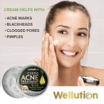 Cystic Acne Spot Treatment – Tea Tree Acne Cream – Fast-Acting Acne Spot Corrector for Face, Pimples & Blemishes – Non-Greasy, Gentle Formula – 1oz – by WELLUTION - Image 3
