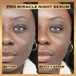 Revolution Pro Miracle Night Rescue Serum Advanced Complex, Overnight Face Serum, Smooths & Plumps Skin with Hyaluronic Acid & Peptides, 1 oz - Image 4
