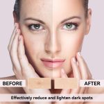 Dark Spot Remover for Face, Dark Spot Corrector for Age Spot Sun Spot Brown Spot Melasma Uneven Skin Tone, with Vitamin C and Hyaluronic Acid for Women and Men, 1.7 FL OZ - Image 4
