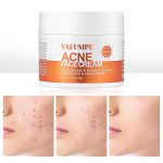 Acne Treatment for Face for Hormonal Cystic Stubborn Acne Cream for Sensitive Skin Teens Adults Women Men Spot Pimple Butt Control Rapid Clearing Breakout Overnight Face Blemish Treatment Moisturizer - Image 2