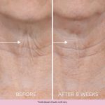 DEKLIDERM Neck Firming Cream – Anti Aging Retinol Cream Visibly Reduces Neck Wrinkles and Sagging – Neck Cream for loss of Firmness - Image 5